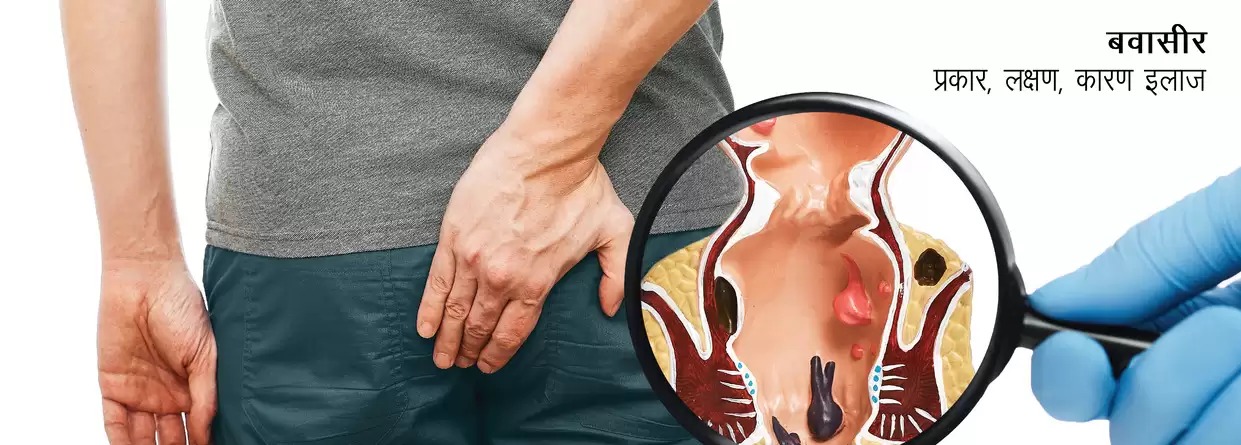 बवासीर ( Piles ) के लक्षण के पहचान, अपनाए घरेलू रामबाण इलाज !
